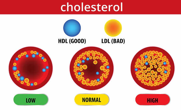 tim-hieu-ve-benh-cholesterol-cao-nhung-dieu-co-ban-can-biet-phan-4.jpg (90 KB)