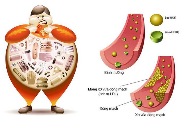 tim-hieu-ve-benh-cholesterol-cao-nhung-dieu-co-ban-can-biet-phan-5.jpg (45 KB)